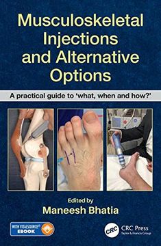 portada Musculoskeletal Injections and Alternative Options: A Practical Guide to 'what, When and How? 'w (in English)