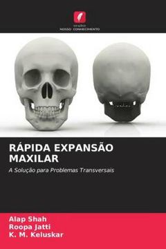 portada Rápida Expansão Maxilar: A Solução Para Problemas Transversais