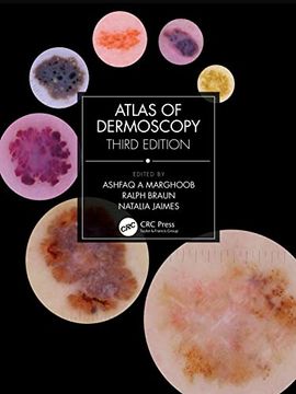 portada Atlas of Dermoscopy: Third Edition (en Inglés)