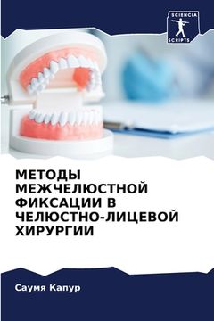 portada МЕТОДЫ МЕЖЧЕЛЮСТНОЙ ФИК& (in Russian)