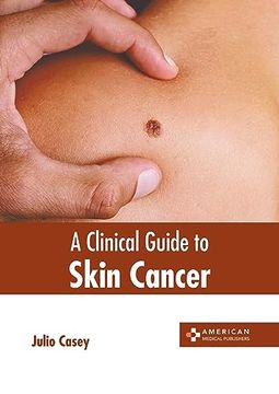 portada A Clinical Guide to Skin Cancer (en Inglés)