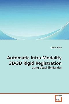 portada automatic intra-modality 3d/3d rigid registration (in English)