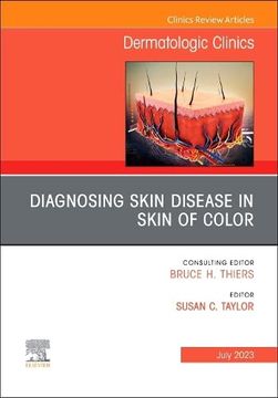 portada Diagnosing Skin Disease in Skin of Color, an Issue of Dermatologic Clinics (Volume 41-3) (The Clinics: Dermatology, Volume 41-3) (en Inglés)