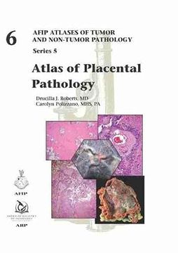 portada Atlas of Placental Pathology (Afip Atlas of Tumor and Non-Tumor Pathology, Series 5) (en Inglés)