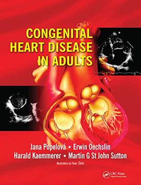 portada Congenital Heart Disease in Adults (en Inglés)