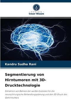 portada Segmentierung von Hirntumoren mit 3D-Drucktechnologie (en Alemán)