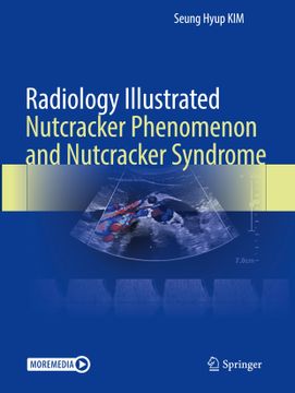 portada Radiology Illustrated: Nutcracker Phenomenon and Nutcracker Syndrome (en Inglés)