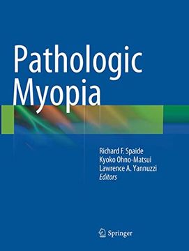 portada Pathologic Myopia (en Inglés)