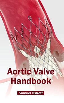 portada Aortic Valve Handbook (en Inglés)