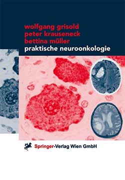 portada Praktische Neuroonkologie (in German)