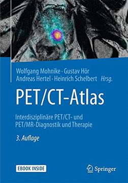 portada PET/CT-Atlas: Interdisziplinäre PET/CT- und PET/MR-Diagnostik und Therapie