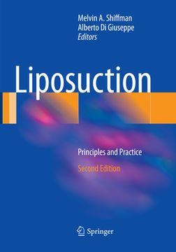 portada Liposuction: Principles and Practice (en Inglés)