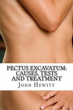 portada Pectus Excavatum: Causes, Tests and Treatment