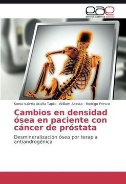 portada Cambios en densidad ósea en paciente con cáncer de próstata: Desmineralización ósea por terapia antiandrogénica (Spanish Edition)