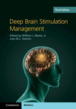 portada Deep Brain Stimulation Management (en Inglés)