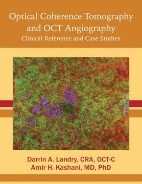 portada Optical Coherence Tomography and oct Angiography: Clinical Reference and Case Studies (en Inglés)
