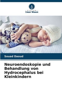portada Neuroendoskopie und Behandlung von Hydrocephalus bei Kleinkindern (en Alemán)