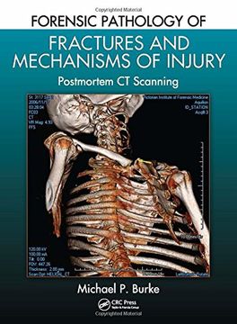 portada Forensic Pathology of Fractures and Mechanisms of Injury: Postmortem CT Scanning (en Inglés)
