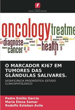 portada O Marcador Ki67 em Tumores das Glândulas Salivares. Significância Prognóstica: Estudo Clinicopatológico (en Portugués)