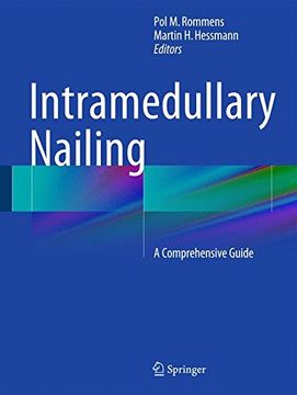 portada Intramedullary Nailing: A Comprehensive Guide