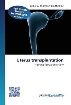 portada Uterus transplantation (en Inglés)