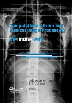 portada Computational Vision and Medical Image Processing: Vipimage 2011 (en Inglés)