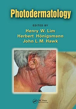 portada Photodermatology (en Inglés)