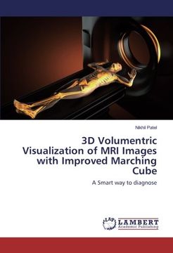 portada 3D Volumentric Visualization of MRI Images with Improved Marching Cube: A Smart way to diagnose
