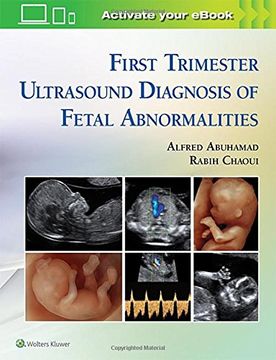 portada First Trimester Ultrasound Diagnosis of Fetal Abnormalities (en Inglés)