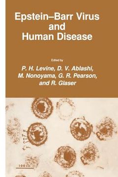portada Epstein-Barr Virus and Human Disease (en Inglés)
