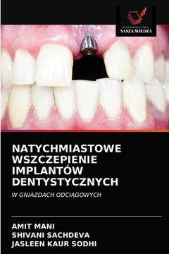 portada Natychmiastowe Wszczepienie Implantów Dentystycznych (en Polaco)