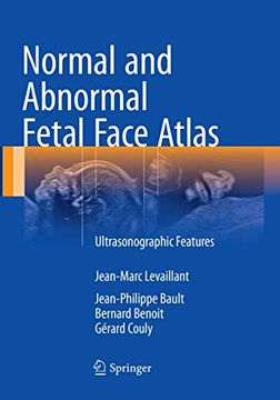 portada Normal and Abnormal Fetal Face Atlas: Ultrasonographic Features (en Inglés)