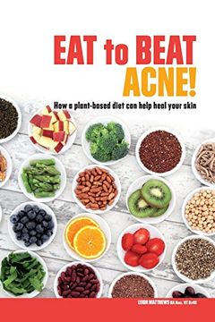 portada Eat to Beat Acne! How a Plant-Based Diet can Help Heal Your Skin. (Eat Your way to Healthier Skin) (en Inglés)