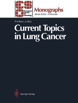 portada current topics in lung cancer (en Inglés)