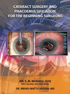 portada Cataract Surgery And Phacoemulsification For The Beginning   Surgeons
