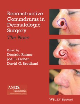 portada Reconstructive Conundrums in Dermatologic Surgery: The Nose (en Inglés)