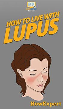 portada How to Live With Lupus: Your Step by Step Guide to Living With Lupus 