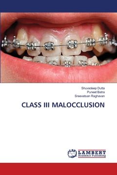 portada Class III Malocclusion (en Inglés)