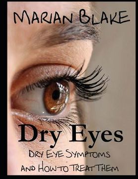 portada Dry Eyes (Large Print): Dry Eye Symptoms and how to treat them (en Inglés)