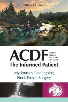 portada Acdf: The Informed Patient: My Journey Undergoing Neck Fusion Surgery (en Inglés)