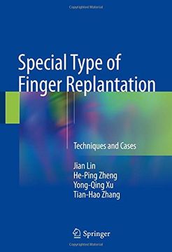 portada Special Type of Finger Replantation: Techniques and Cases (en Inglés)