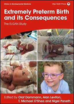 portada Extremely Preterm Birth and its Consequences: The Elgan Study (Clinics in Developmental Medicine) (en Inglés)