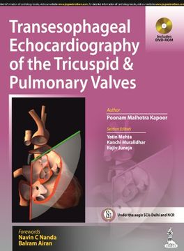 portada Transesophageal Echocardiography of the Tricuspid and Pulmonary Valves