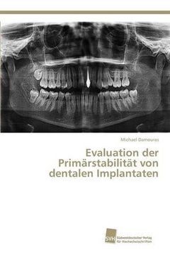 portada Evaluation der Primärstabilität von dentalen Implantaten