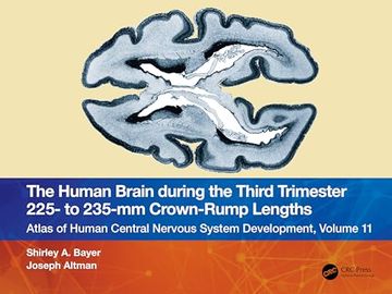 portada The Human Brain During the Third Trimester 225– to 235–Mm Crown-Rump Lengths: Atlas of Central Nervous System Development, Volume 11 (Atlas of Human Central Nervous System Development, 11) (en Inglés)