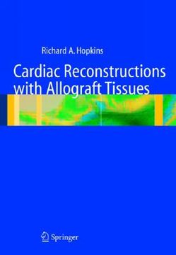 portada cardiac reconstructions with allograft tissues (en Inglés)