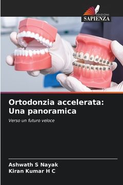 portada Ortodonzia accelerata: Una panoramica (en Italiano)