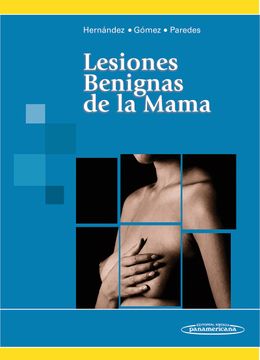 portada Lesiones Benignas de la Mama (in Spanish)
