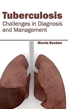 portada Tuberculosis: Challenges in Diagnosis and Management