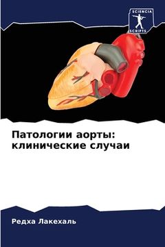 portada Патологии аорты: клиниче (en Ruso)